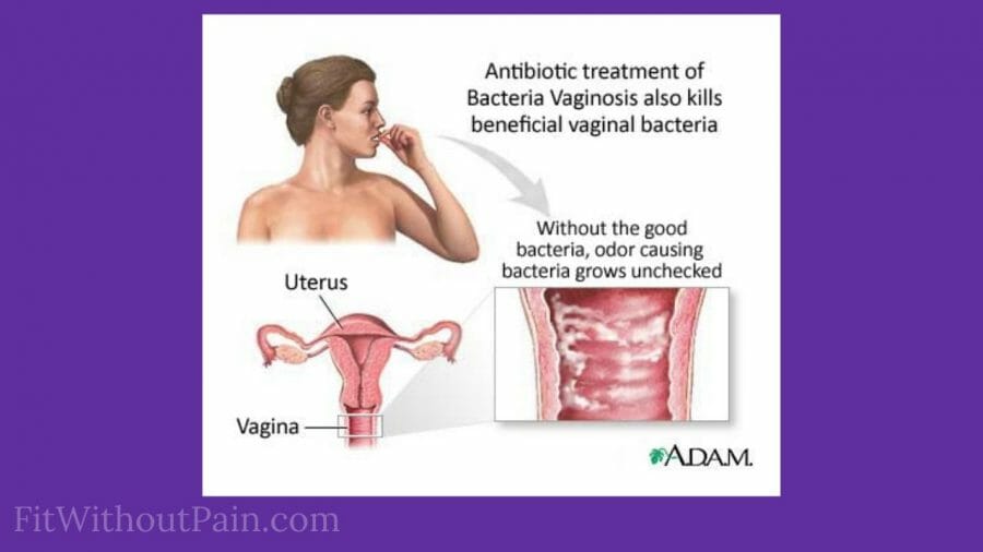 BV No More Review Finally Get Rid Of Bacterial Vaginosis?