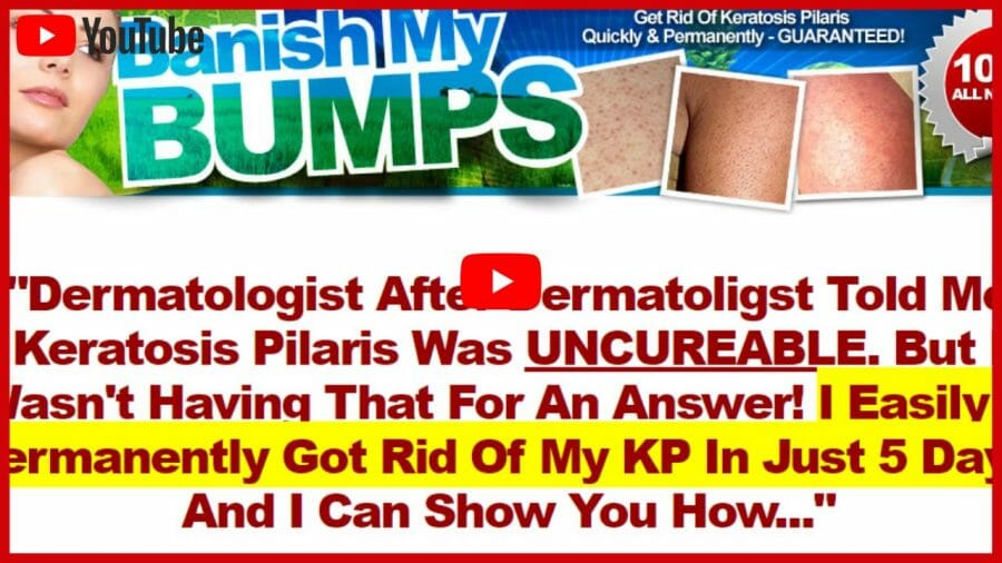Banish My Bumps Review Can You Make Those Bumps Go Away?